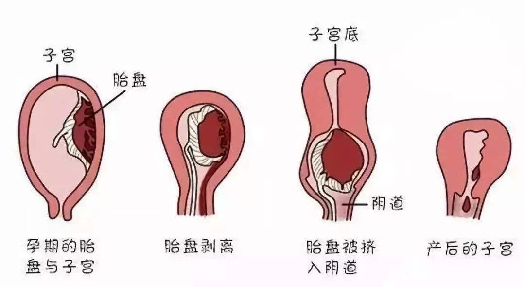 药流后半个月可以同房吗？解读与探讨